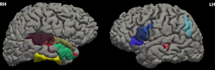 Longitudinal Multimodal Magnetic Resonance Imaging Reveals Improvement in Verbal Fluency Over Time in Moderate-to-Severe Traumatic Brain Injury.