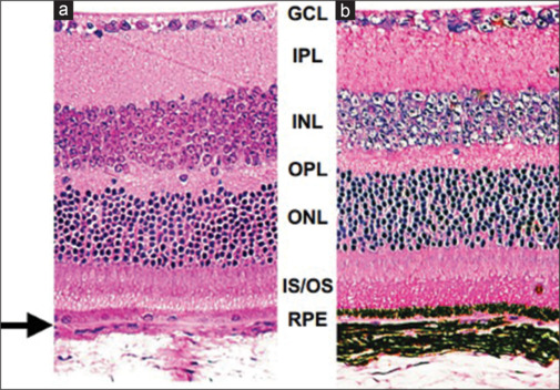 Development of a BALB/c mice model for blue light retinal damage.