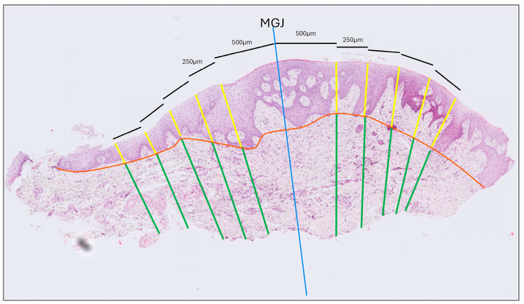 Histomorphometric Evaluation of Gingival Phenotypic Characteristics: A Cross-Sectional Study.
