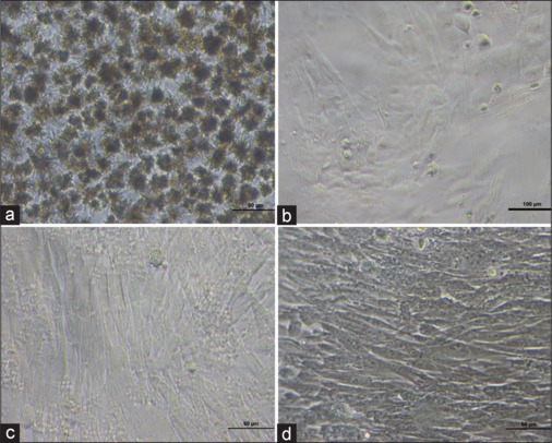 Effects of mouthwash exposure to stainless steel temporary anchorage device on cytotoxicity and inflammation levels of BHK-21 cells.