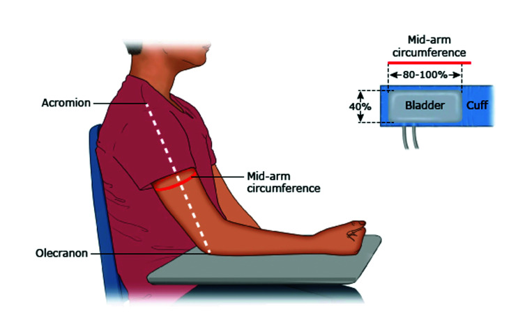 Approach to Diagnosis and Management of Pediatric Hypertension in an Outpatient Setting.