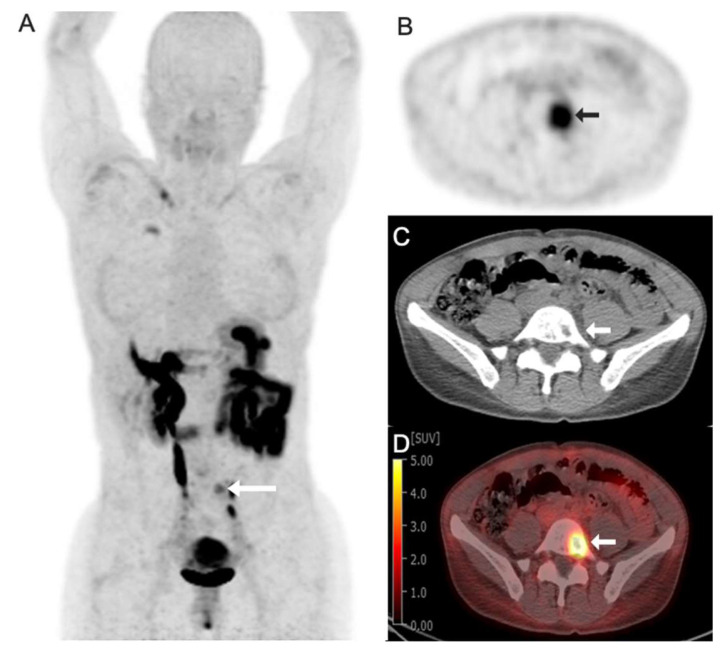 Emerging PET Imaging Agents and Targeted Radioligand Therapy: A Review of Clinical Applications and Trials.