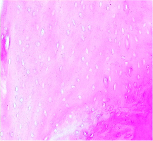 The mechanism of NK cell expression of RANKL/RANK/OPG pathway in mouse models of femoral head necrosis.