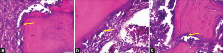 Enhanced osteogenic marker expression in alveolar bone via hydroxyapatite gypsum puger cassava starch scaffold: An in vivo study.