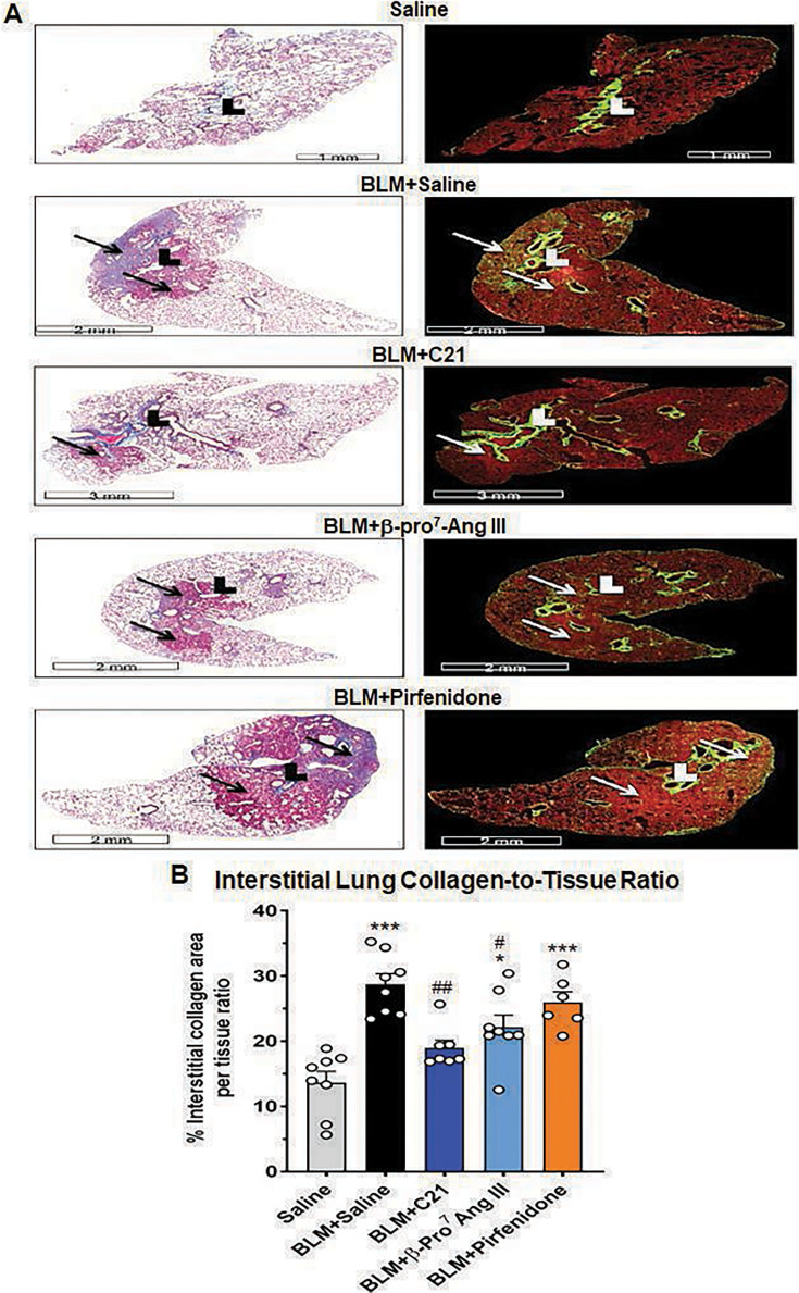 The novel AT2 receptor ligand, β-Pro7 Ang III, induces equivalent anti-fibrotic effects to Compound 21 but broader anti-fibrotic effects than pirfenidone in mice with bleomycin-induced pulmonary fibrosis.