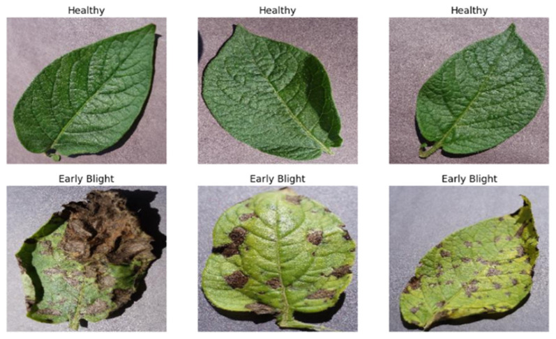 Advancing Early Blight Detection in Potato Leaves Through ZeroShot Learning.