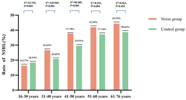 Associations Between Occupational Noise Exposure, Aging, and Gender and Hearing Loss: A Cross-Sectional Study in China.