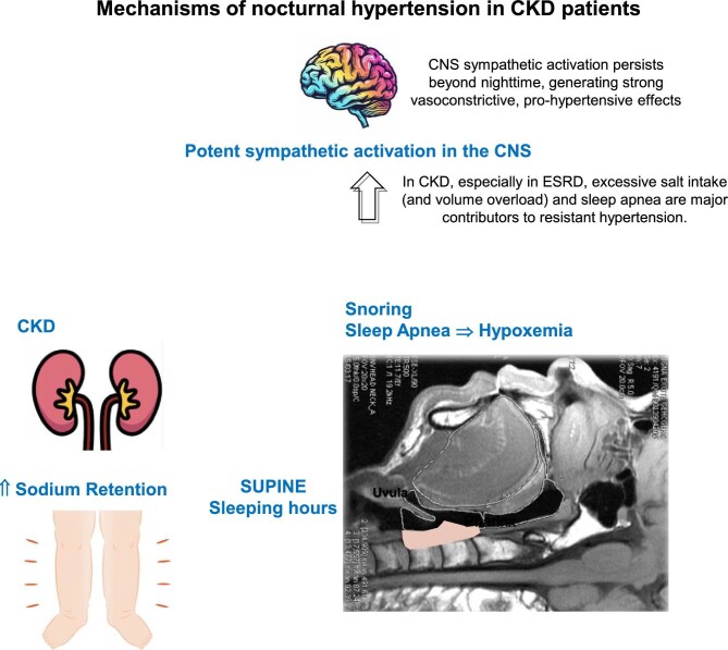 Hypertension burden in CKD: is nocturnal hypertension the primary culprit?