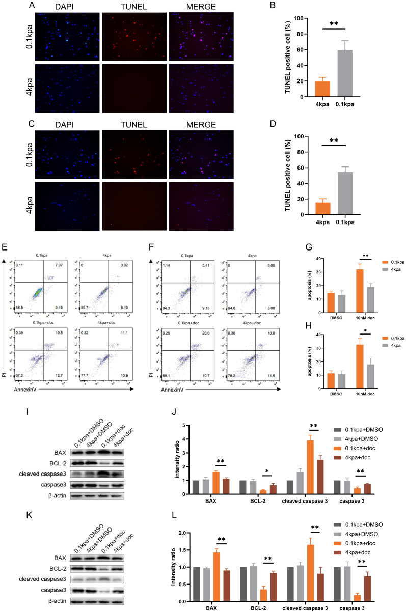 Extracellular Matrix Stiffness Enhancement Promotes Docetaxel Resistance in Prostate Cancer via Inhibition of Apoptosis Mediated by Upregulation of PRRX1.
