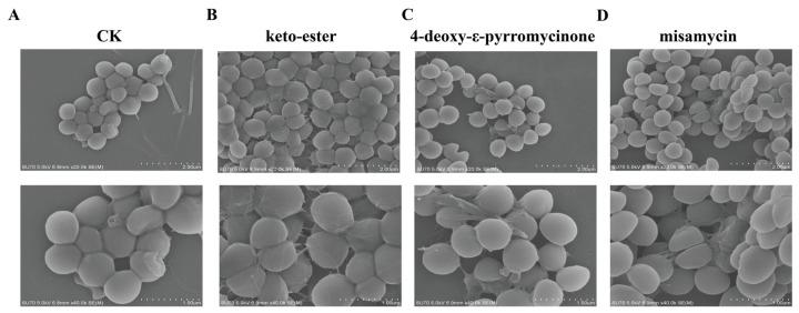 Antimicrobial and Antibiofilm Activity of Marine <i>Streptomyces</i> sp. NBUD24-Derived Anthraquinones Against MRSA.
