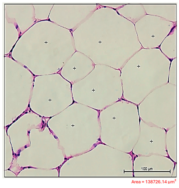 The Intersection Between <i>Schistosoma mansoni</i> Infection and Dyslipidemia Modulates Inflammation in the Visceral Adipose Tissue of Swiss Webster Mice.