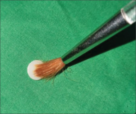 To evaluate the surface roughness and color stability of 3D-printed polymethyl methacrylate resin at three printing orientations following polishing and coating: An in vitro study.