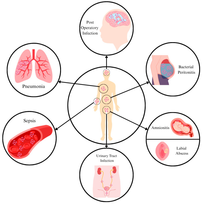 Beyond the Usual Suspects: <i>Weeksella virosa</i> as a Potential Human and Animal Pathogen.
