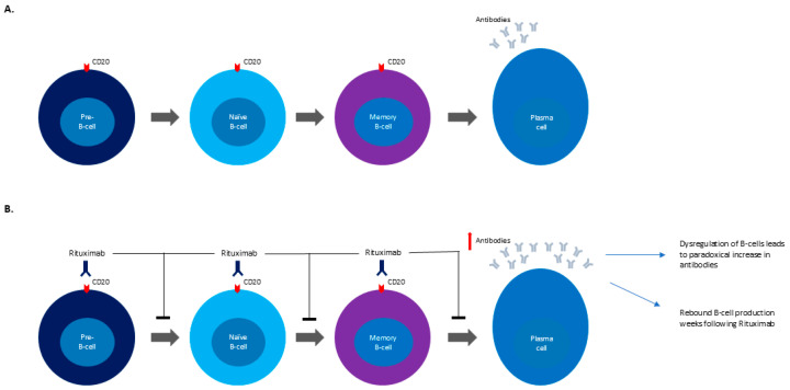 A Possible Association Between Rituximab and the Subsequent Development of Guillain-Barré Syndrome: A Case Report.