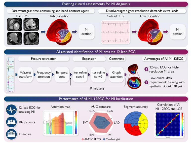 Artificial intelligence-based accurate myocardial infarction mapping using 12-lead electrocardiography.