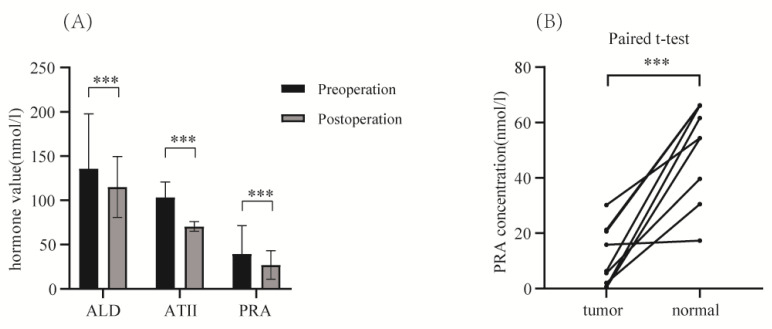 Nomogram for Predicting Postoperative Blood Pressure Reduction in Hypertensive Patients: A Single-Center Retrospective Study.