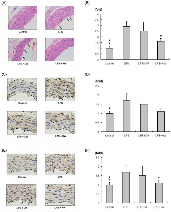 Vascular Endothelial Protection Effects of <i>Curcuma wenyujin</i> Root Aqueous Extracts on LPS-induced Rat Vascular Damage.
