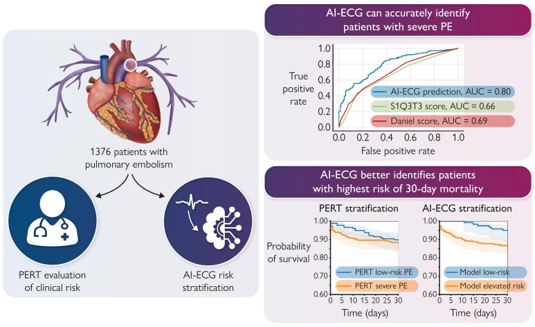 Artificial intelligence-driven electrocardiogram analysis for risk stratification in pulmonary embolism.