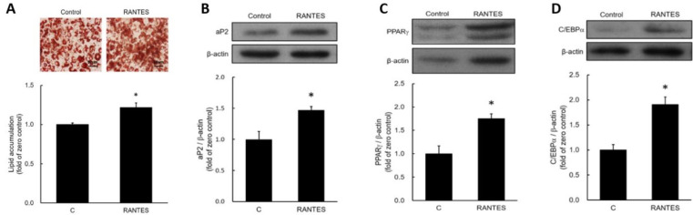 C-C chemokine receptor type 5 activation stimulates adipocyte differentiation through ERK-dependent pathway.