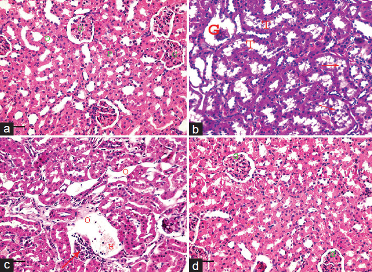 Resveratrol Alleviates Aflatoxin B1-induced Renal Cortex Oxidative Stress and Apoptosis in Adult Male Albino Rats.