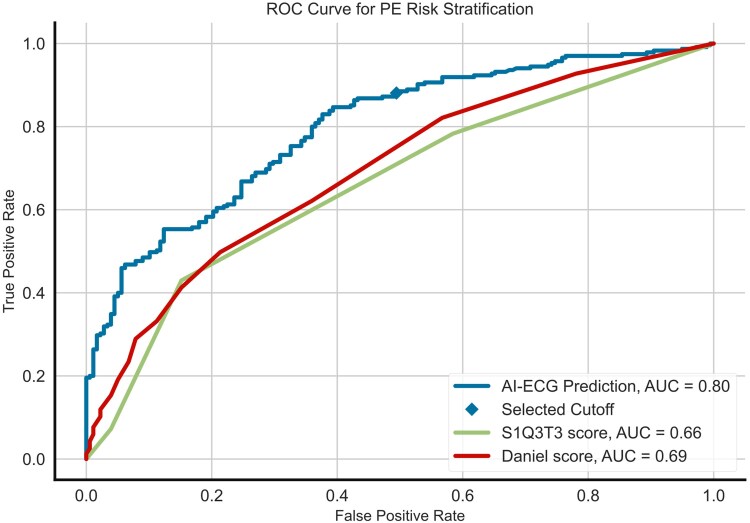 Artificial intelligence-driven electrocardiogram analysis for risk stratification in pulmonary embolism.