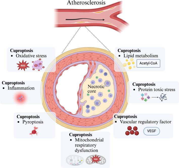 The molecular mechanisms of cuproptosis and its relevance to atherosclerosis.