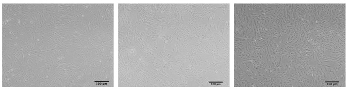 Mesenchymal Stem Cells Senescence: Mechanism and Rejuvenation Interventions.