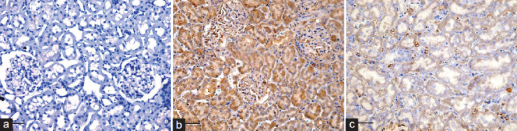 Resveratrol Alleviates Aflatoxin B1-induced Renal Cortex Oxidative Stress and Apoptosis in Adult Male Albino Rats.