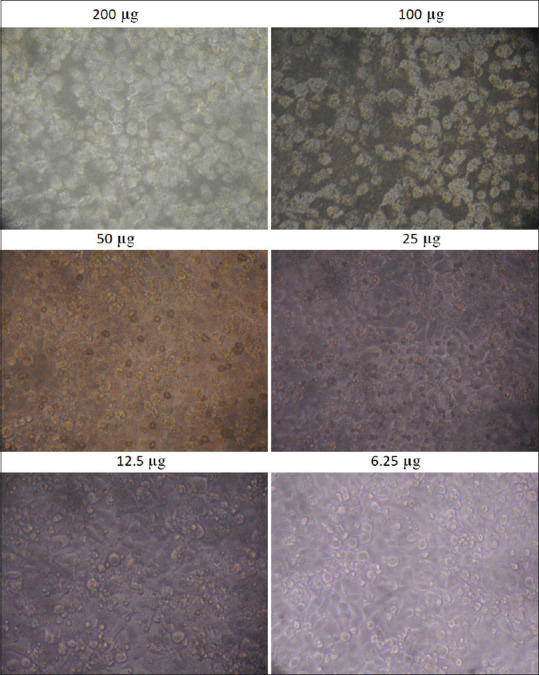 Evaluation of cytotoxic effects of fruit extracts on oral cancer cell lines: An <i>in vitro</i> experimental study.