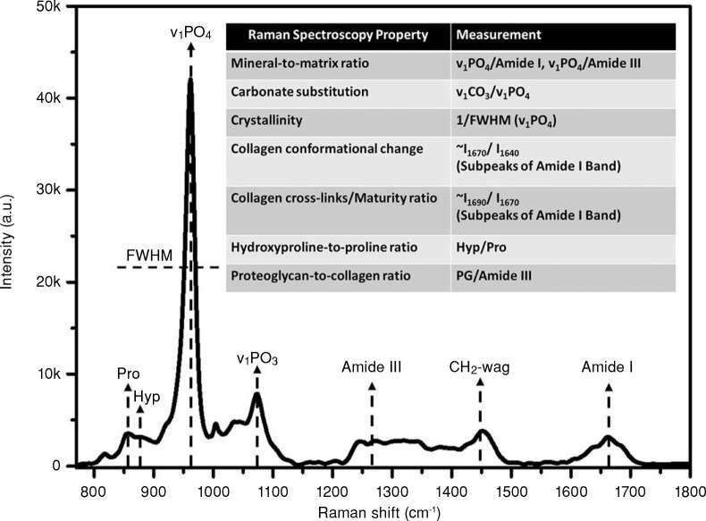 Potential preventive effects of angiotensin-(1-7) on bone matrix quality in diabetic rats through modulation of the organic matrix.