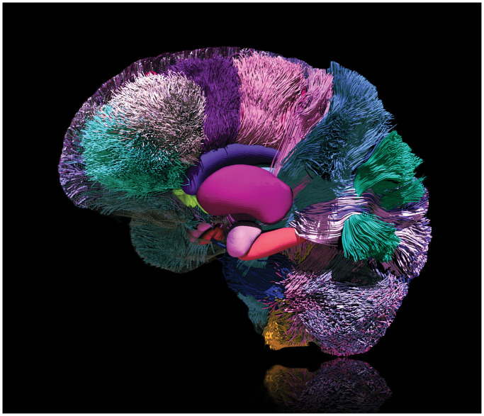 MindMap: the intricate connections of the human brain.