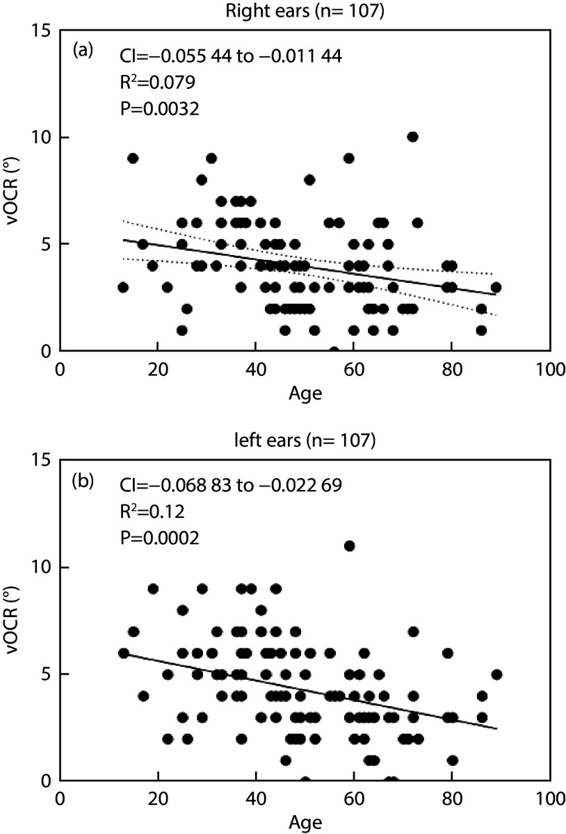 Otolith Degeneration with Aging: Insights from Video Ocular Counter-Roll (vOCR) Assessment.