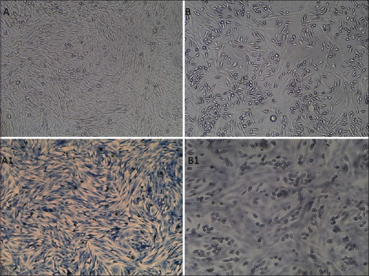 Swertia purpurascens Wall: Evaluation of its antifibrotic activity in an <i>in vitro</i> model of oral submucous fibrosis.