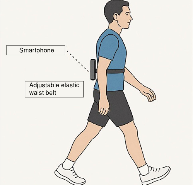Gait analysis and functional assessment of conservatively treated calcaneal fractures.