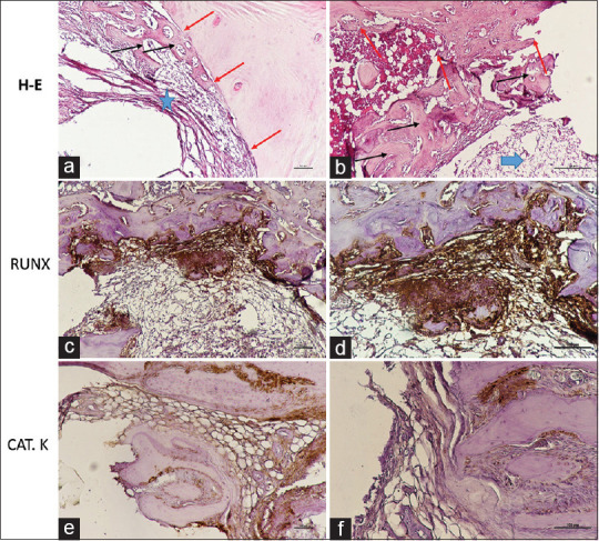 Osteogenic effects of metformin and exenatide on bone regeneration in non-diabetic rats: A Micro-CT and histological study.