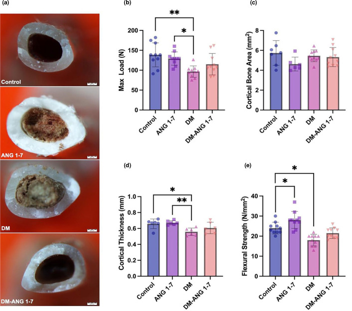 Potential preventive effects of angiotensin-(1-7) on bone matrix quality in diabetic rats through modulation of the organic matrix.