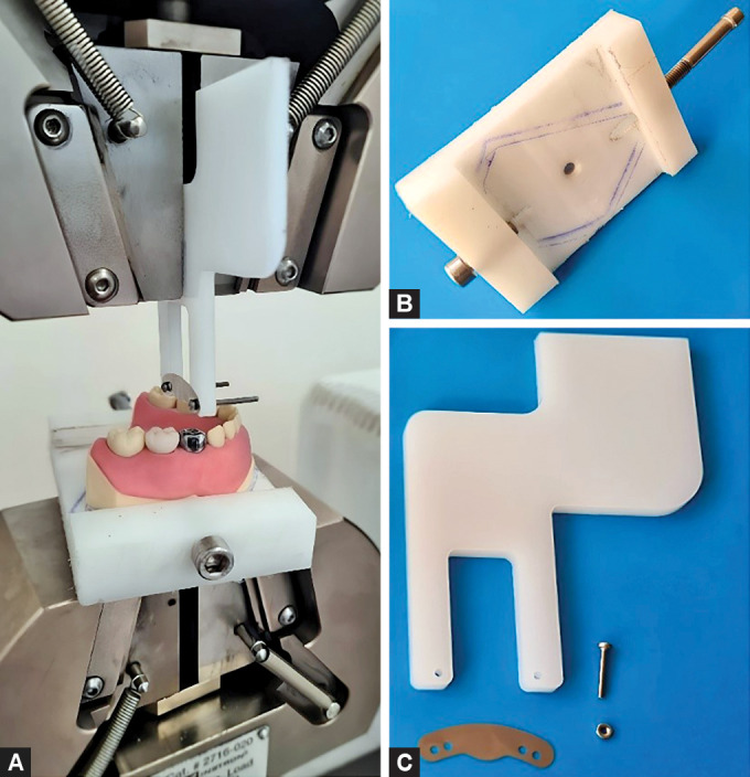 <i>In Vitro</i> Evaluation of Contact Tightness and Marginal Overhang in Class II Primary Molar Restorations Restored with Different Matrix Systems.