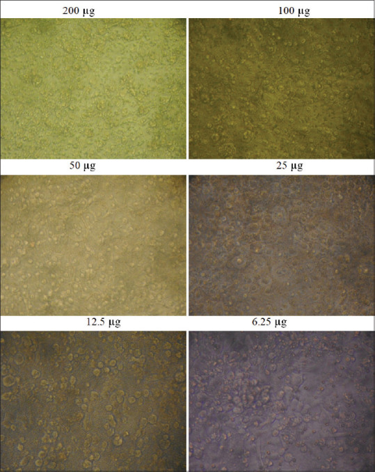 Evaluation of cytotoxic effects of fruit extracts on oral cancer cell lines: An <i>in vitro</i> experimental study.