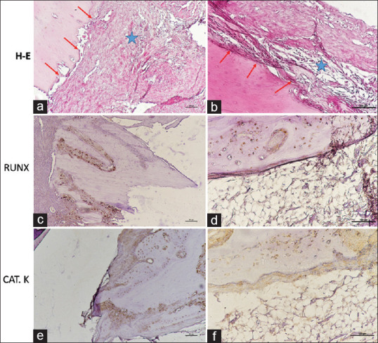 Osteogenic effects of metformin and exenatide on bone regeneration in non-diabetic rats: A Micro-CT and histological study.