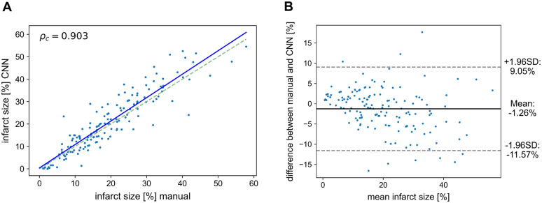 Deep learning pipeline for fully automated myocardial infarct segmentation from clinical cardiac MR scans.