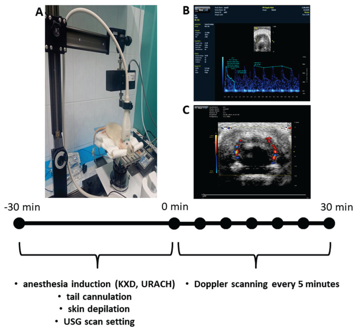 The non-invasive transcranial Doppler for hemodynamic monitoring.