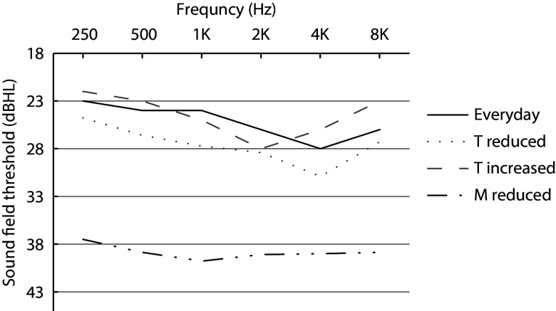 Effect of minimum and maximum electrical stimulation levels on sound field thresholds,and speech perception in children using the Advanced Bionics Cochlear Implant.
