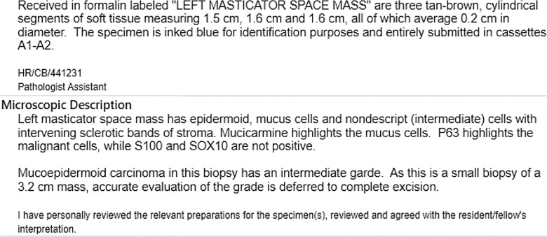 Primary Mucoepidermoid Carcinoma of the Masticator Space Presenting with Myasthenia Gravis.