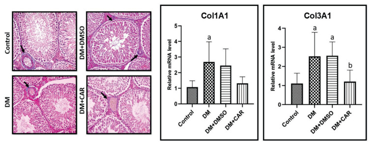 Effect of carvacrol on diabetes-induced oxidative stress, fibrosis and apoptosis in testicular tissues of adult rats.