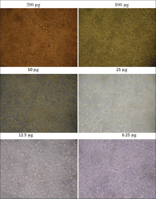 Evaluation of cytotoxic effects of fruit extracts on oral cancer cell lines: An <i>in vitro</i> experimental study.