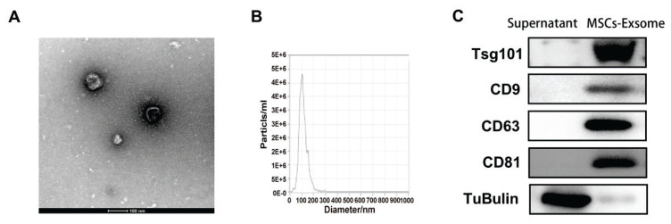 Protective mechanisms of exosomes derived from human umbilical cord mesenchymal stem cells in bronchopulmonary dysplasia.