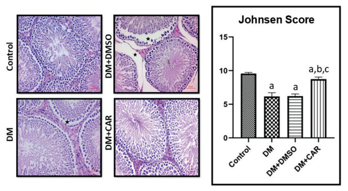Effect of carvacrol on diabetes-induced oxidative stress, fibrosis and apoptosis in testicular tissues of adult rats.