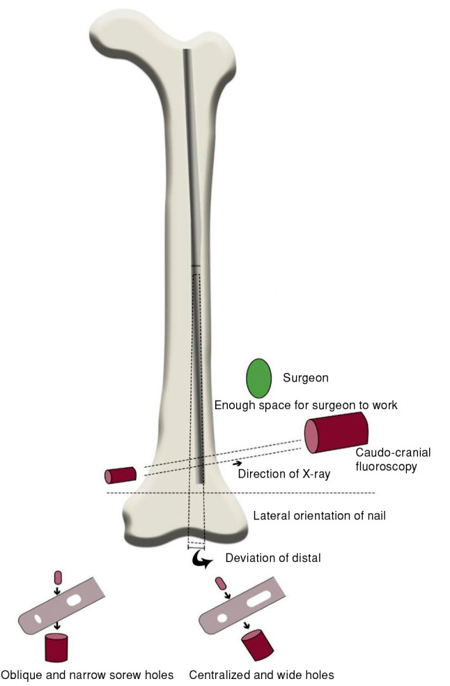 Evaluation of the effect of eccentric nailing on femoral diaphyseal union delay.