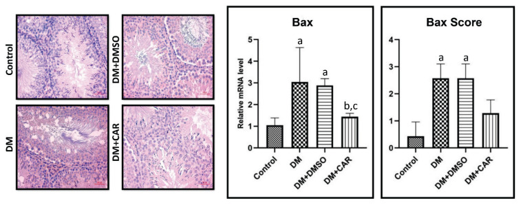 Effect of carvacrol on diabetes-induced oxidative stress, fibrosis and apoptosis in testicular tissues of adult rats.