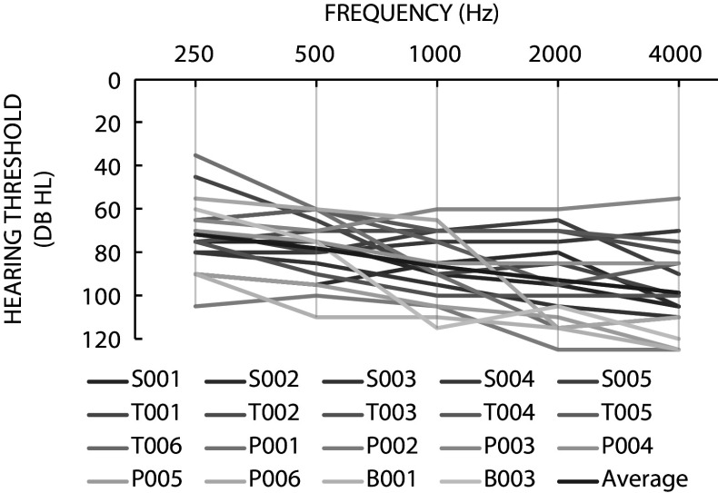 The Effect of Binaural Beamforming Technology on Mandarin Speech Recognition in Babble Noise for Bimodal Hearing CI users.